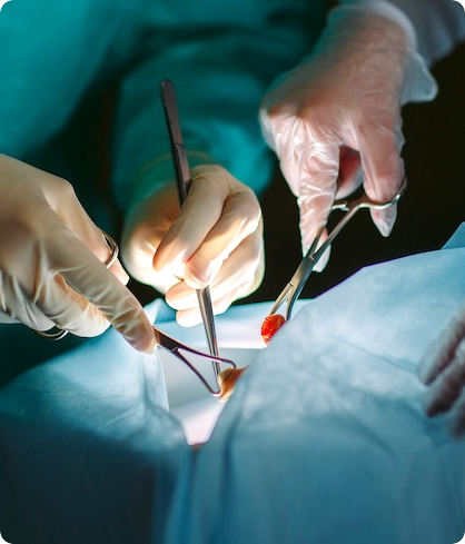 Surgical Instruments