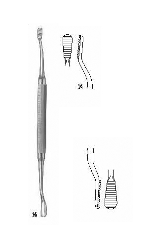 Alvotomy File, Elevators